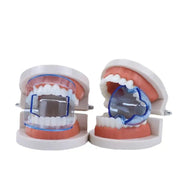 Oral Cheek Retractor - 2