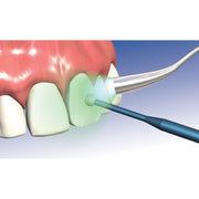 Microbrush Micro-Stix - Original (64)