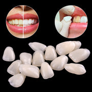 Teeth Whitening Resin - 0