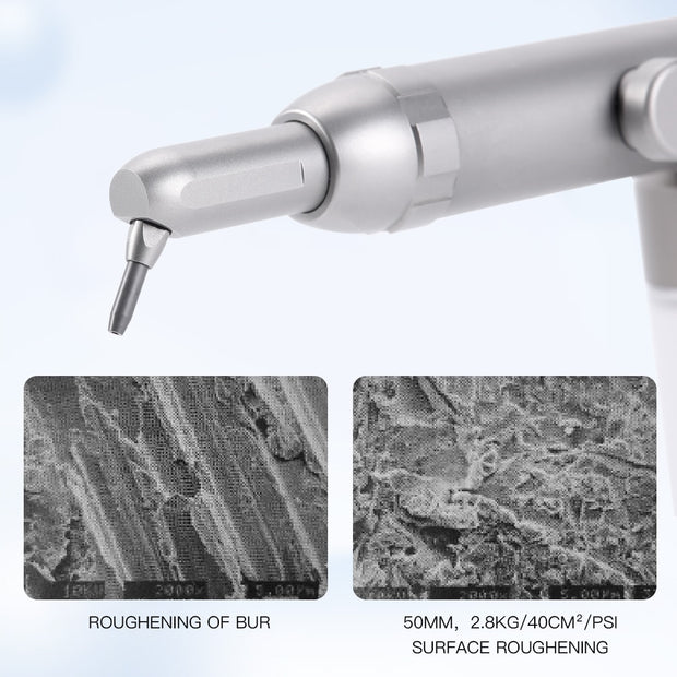 Dental Alumina Air Abrasion Scaler